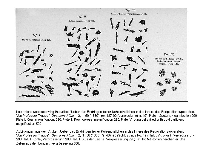 Excerpts from a Clinical Report and Autopsy by Professor Traube on a Patient with Lung Disease caused by Coal Dust (1860)